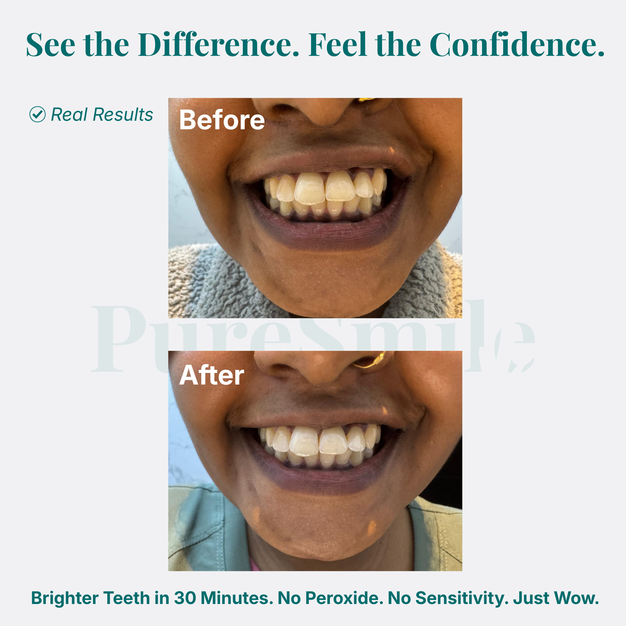 PureSmile Halal Whitening Protocol