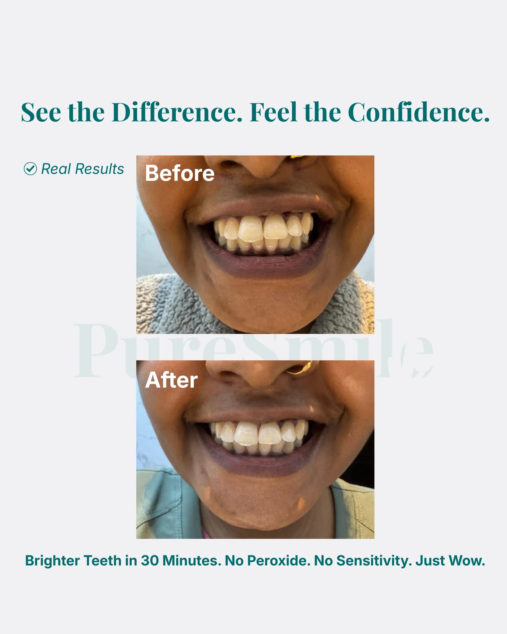 PureSmile teeth whitening gift UAE, Halal certified Eid and wedding gift Dubai